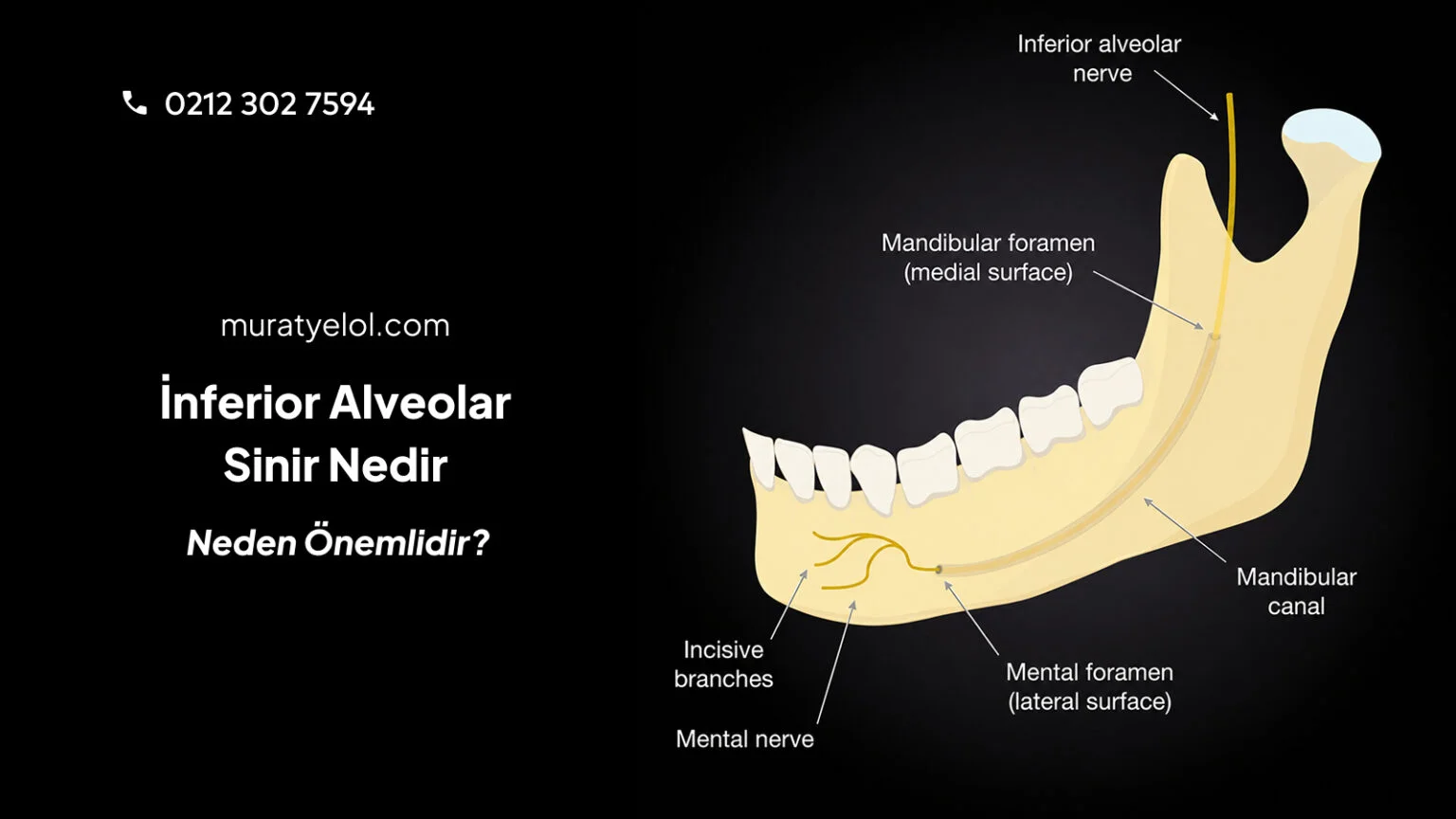 İnferior Alveolar Sinir