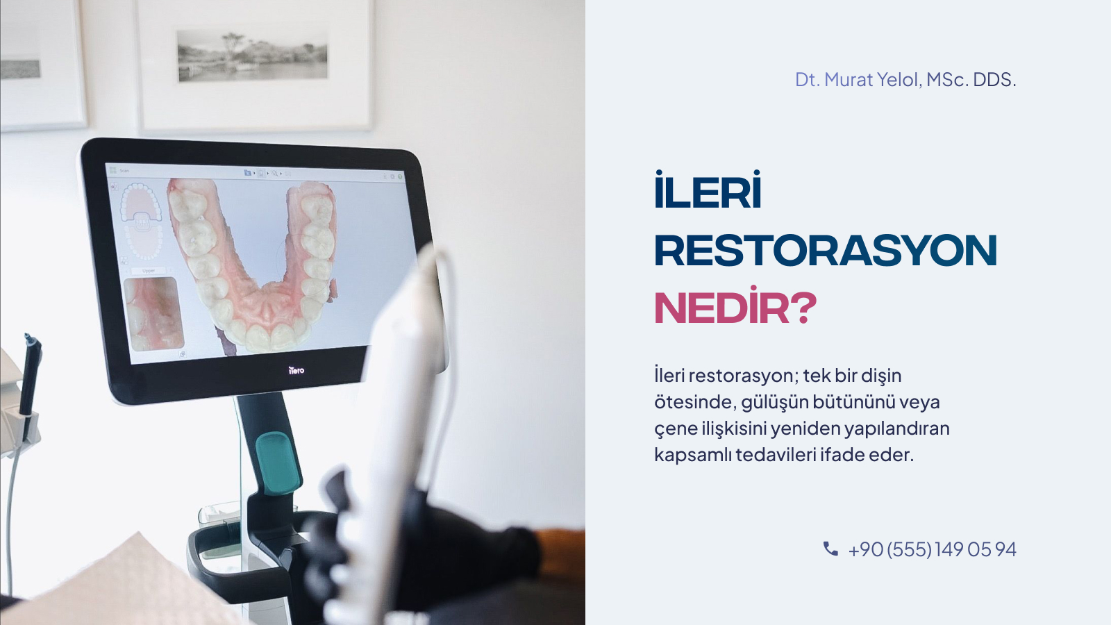 Dijital Gülüş Tasarımı ve İleri Restorasyon: Süreç Nasıl İşler?