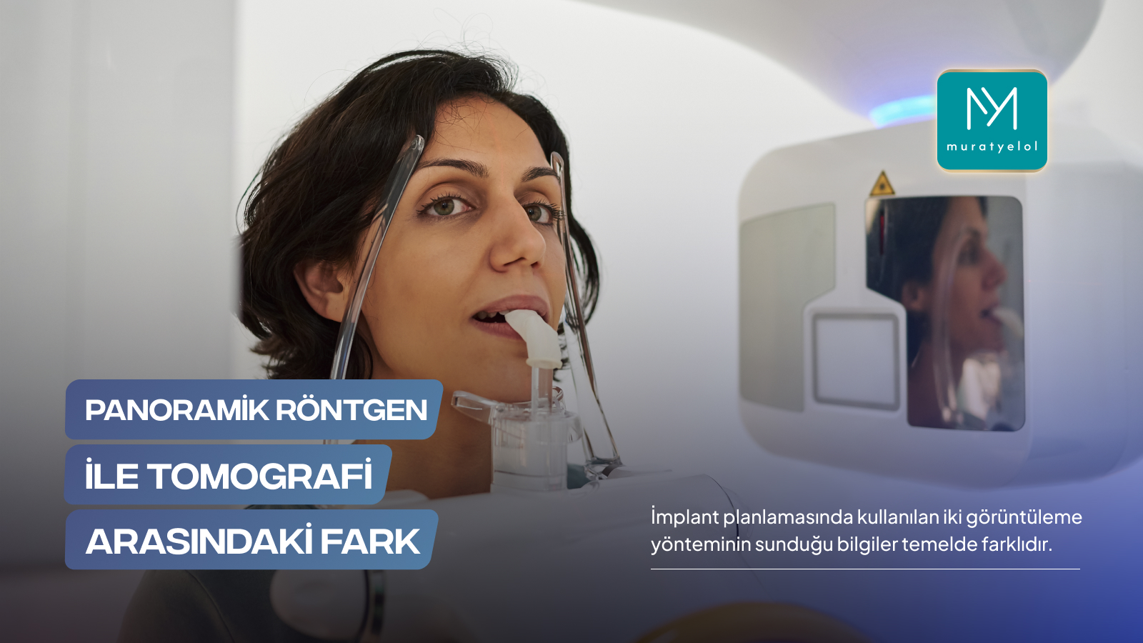 Tomografiye Göre İmplant Yeri Neden Değişebilir?