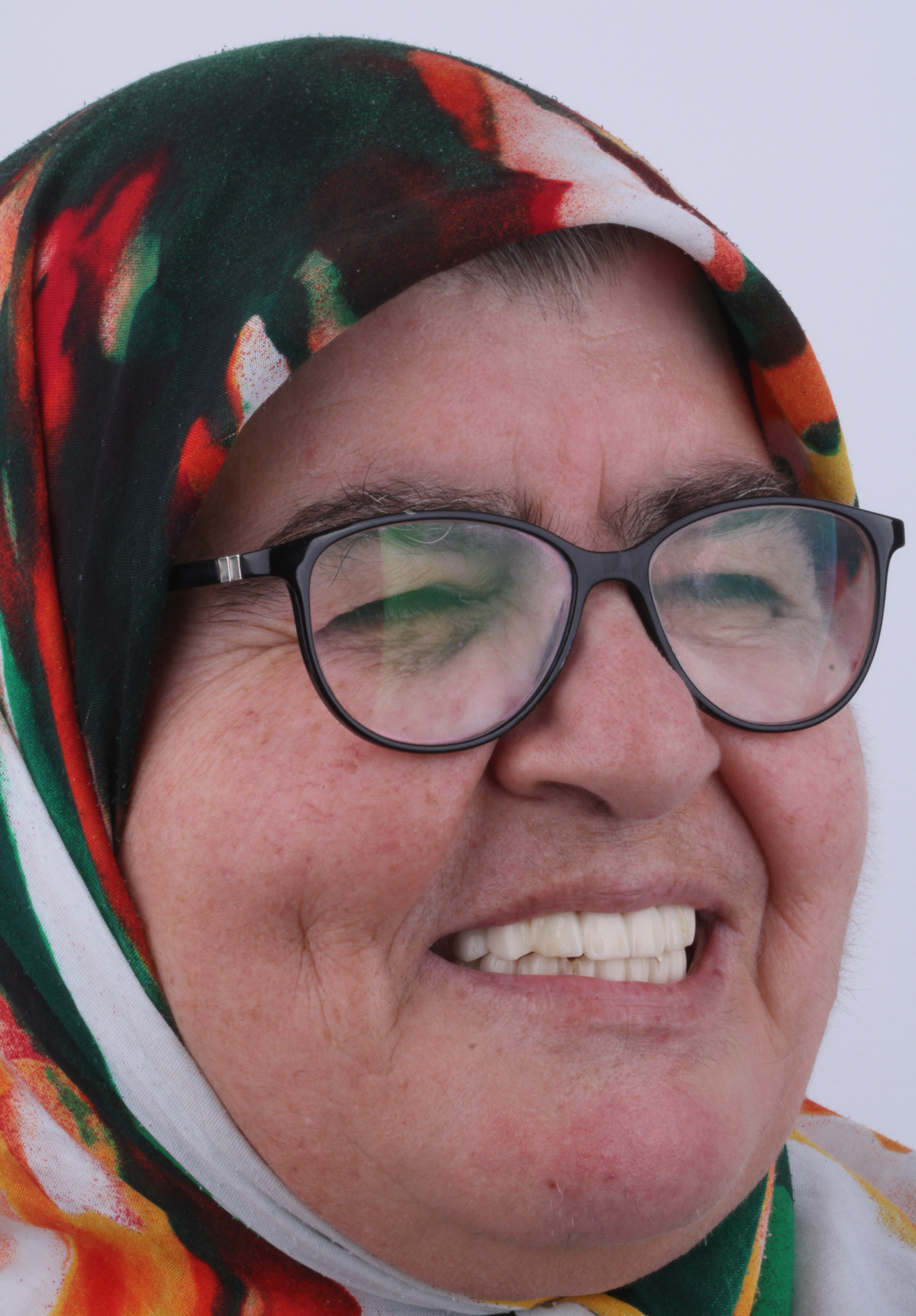 Çift Çene All-On-Four İmplant Tedavisi Vaka Analizi | Dt. Murat Yelol 2